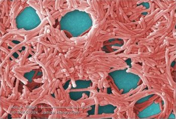 Legionella pneumophila - Legionellabakterier sett med mikroskop